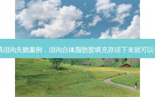 自体脂肪填泪沟失败案例，泪沟自体脂肪胶填充存活下来就可以一直存在吗