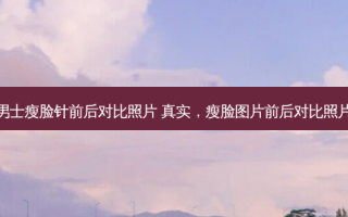 男士瘦脸针前后对比照片 真实，瘦脸图片前后对比照片