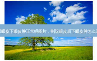 割双眼皮下眼皮肿正常吗图片，割双眼皮后下眼皮肿怎么回事
