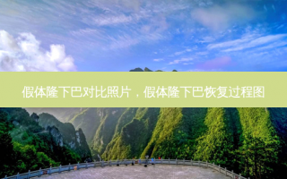 假体隆下巴对比照片，假体隆下巴恢复过程图
