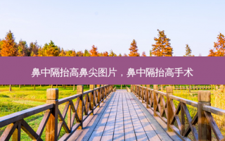 鼻中隔抬高鼻尖图片，鼻中隔抬高手术