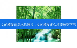 女的植发前后术后照片，女的植发多久才能长到下巴