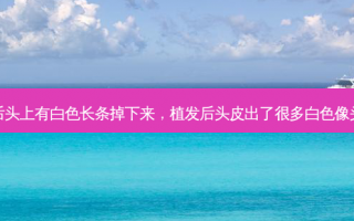 植发后头上有白色长条掉下来，植发后头皮出了很多白色像头皮屑