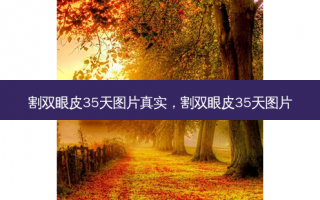 割双眼皮35天图片真实，割双眼皮35天图片
