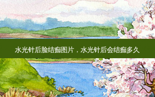 水光针后脸结痂图片，水光针后会结痂多久