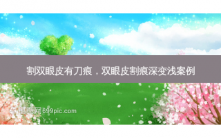 割双眼皮有刀痕，双眼皮割痕深变浅案例