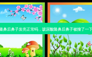 隆鼻后鼻子发亮正常吗，玻尿酸隆鼻后鼻子被撞了一下
