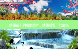 抽脂留下的疤痕图片，抽脂后留下的疤痕