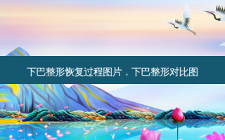 下巴整形恢复过程图片，下巴整形对比图