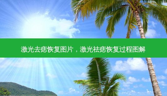 激光去痣恢复图片，激光祛痣恢复过程图解-第1张图片-琢颜网 - 美丽容颜从这里开始