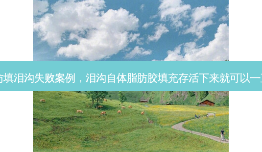 自体脂肪填泪沟失败案例,泪沟自体脂肪胶填充存活下来就可以一直存在吗-第1张图片-琢颜网 - 美丽容颜从这里开始 自体脂肪填泪沟失败案例,泪沟自体脂肪胶填充存活下来就可以一直存在吗-第1张图片-琢颜网 - 美丽容颜从这里开始