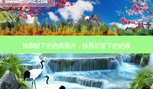 抽脂留下的疤痕图片，抽脂后留下的疤痕-第1张图片-琢颜网 - 美丽容颜从这里开始