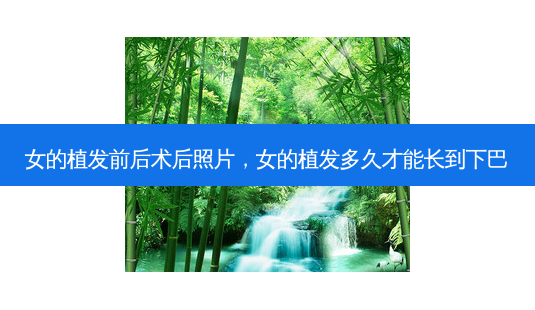 女的植发前后术后照片,女的植发多久才能长到下巴-第1张图片-琢颜网 - 美丽容颜从这里开始 女的植发前后术后照片,女的植发多久才能长到下巴-第1张图片-琢颜网 - 美丽容颜从这里开始