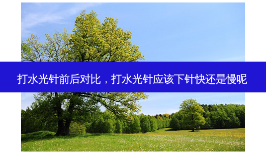 打水光针前后对比,打水光针应该下针快还是慢呢-第1张图片-琢颜网 - 美丽容颜从这里开始 打水光针前后对比,打水光针应该下针快还是慢呢-第1张图片-琢颜网 - 美丽容颜从这里开始