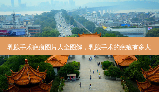 乳腺手术疤痕图片大全图解,乳腺手术的疤痕有多大-第1张图片-琢颜网 - 美丽容颜从这里开始 乳腺手术疤痕图片大全图解,乳腺手术的疤痕有多大-第1张图片-琢颜网 - 美丽容颜从这里开始