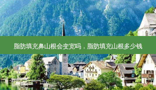 脂肪填充鼻山根会变宽吗,脂肪填充山根多少钱-第1张图片-琢颜网 - 美丽容颜从这里开始 脂肪填充鼻山根会变宽吗,脂肪填充山根多少钱-第1张图片-琢颜网 - 美丽容颜从这里开始