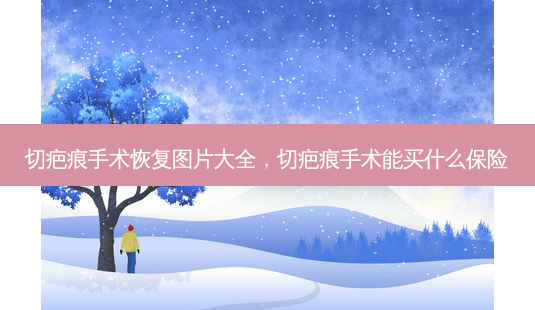 切疤痕手术恢复图片大全,切疤痕手术能买什么保险-第1张图片-琢颜网 - 美丽容颜从这里开始 切疤痕手术恢复图片大全,切疤痕手术能买什么保险-第1张图片-琢颜网 - 美丽容颜从这里开始