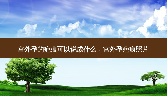 宫外孕的疤痕可以说成什么，宫外孕疤痕照片-第1张图片-琢颜网 - 美丽容颜从这里开始