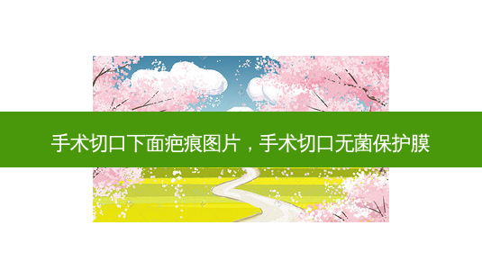 手术切口下面疤痕图片,手术切口无菌保护膜-第1张图片-琢颜网 - 美丽容颜从这里开始 手术切口下面疤痕图片,手术切口无菌保护膜-第1张图片-琢颜网 - 美丽容颜从这里开始