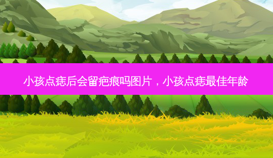 小孩点痣后会留疤痕吗图片,小孩点痣最佳年龄-第1张图片-琢颜网 - 美丽容颜从这里开始 小孩点痣后会留疤痕吗图片,小孩点痣最佳年龄-第1张图片-琢颜网 - 美丽容颜从这里开始