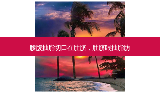 腰腹抽脂切口在肚脐,肚脐眼抽脂肪-第1张图片-琢颜网 - 美丽容颜从这里开始 腰腹抽脂切口在肚脐,肚脐眼抽脂肪-第1张图片-琢颜网 - 美丽容颜从这里开始