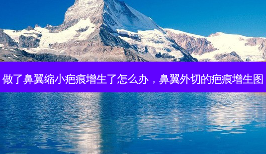 做了鼻翼缩小疤痕增生了怎么办,鼻翼外切的疤痕增生图-第1张图片-琢颜网 - 美丽容颜从这里开始 做了鼻翼缩小疤痕增生了怎么办,鼻翼外切的疤痕增生图-第1张图片-琢颜网 - 美丽容颜从这里开始