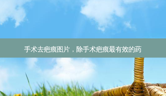 手术去疤痕图片,除手术疤痕最有效的药-第1张图片-琢颜网 - 美丽容颜从这里开始 手术去疤痕图片,除手术疤痕最有效的药-第1张图片-琢颜网 - 美丽容颜从这里开始
