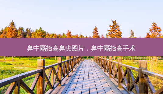鼻中隔抬高鼻尖图片,鼻中隔抬高手术-第1张图片-琢颜网 - 美丽容颜从这里开始 鼻中隔抬高鼻尖图片,鼻中隔抬高手术-第1张图片-琢颜网 - 美丽容颜从这里开始