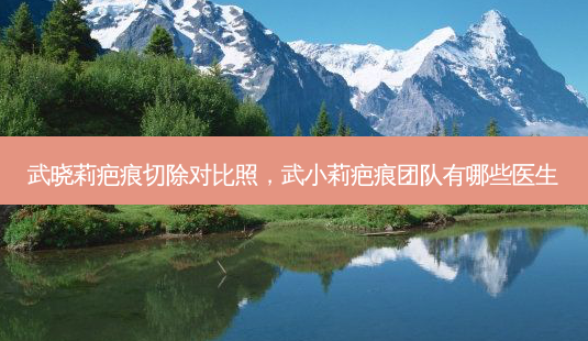 武晓莉疤痕切除对比照,武小莉疤痕团队有哪些医生-第1张图片-琢颜网 - 美丽容颜从这里开始 武晓莉疤痕切除对比照,武小莉疤痕团队有哪些医生-第1张图片-琢颜网 - 美丽容颜从这里开始